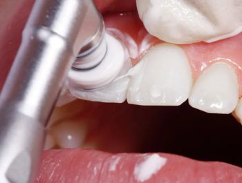 untitled design (10)